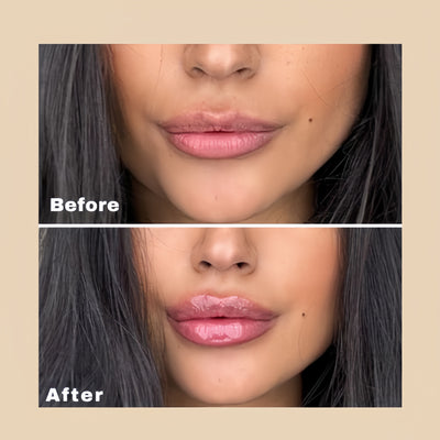Vesatta Lip Plumper